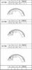 ASIMCO K1738 Brake Shoe Set